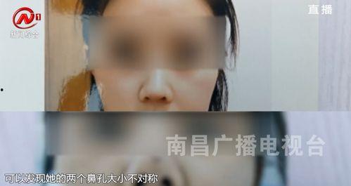 南昌医美爆料事件真相视频,揭秘行业黑幕与患者权益